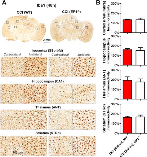 Figure 3 from Role of the Prostaglandin E2 EP1 Receptor in Traumatic ...