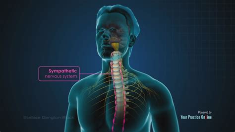 Stellate Ganglion Block Video | Medical Video Library