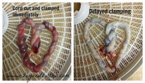 Why "Delayed" Cord Clamping Should Be the Norm | Evolutionary Parenting | Where History And ...