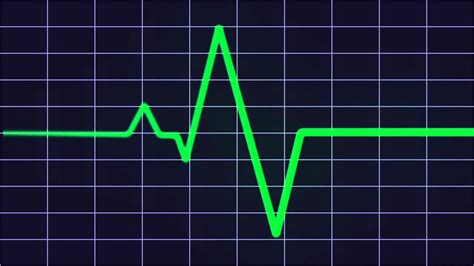 Heart Monitor Flatline Wallpapers - Top Free Heart Monitor Flatline ...