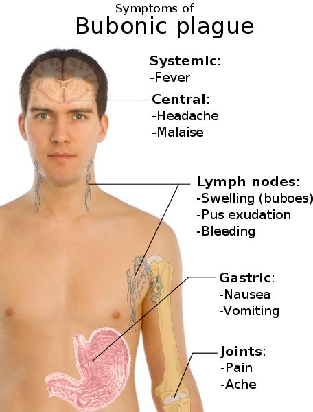 symptoms of black death | capseacusiz