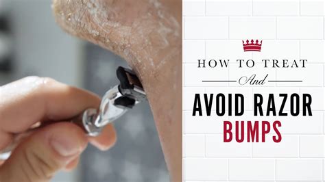 How to Treat and Avoid Razor Bumps - YouTube