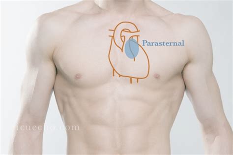 Parasternal long axis - ICU & Echo