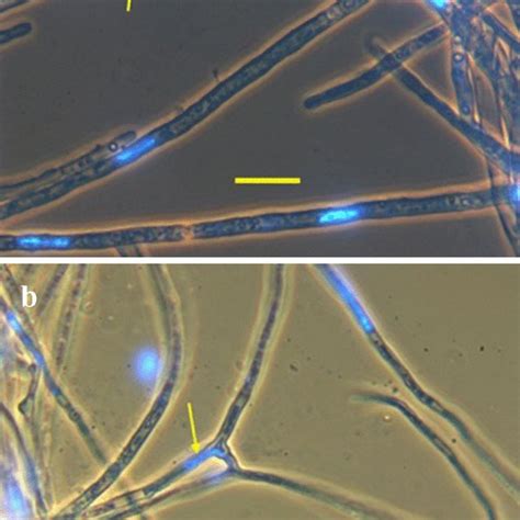 Cytoplasmic bridges (thin arrows) connect one hypha (thick arrow) to 3... | Download Scientific ...