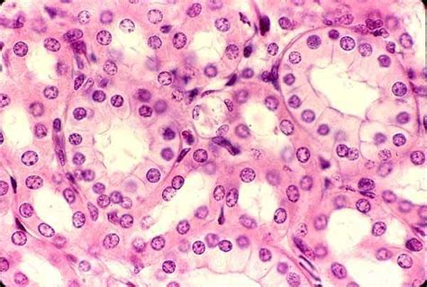 Simple cuboidal epithelium. | Histology | Pinterest | Anatomy