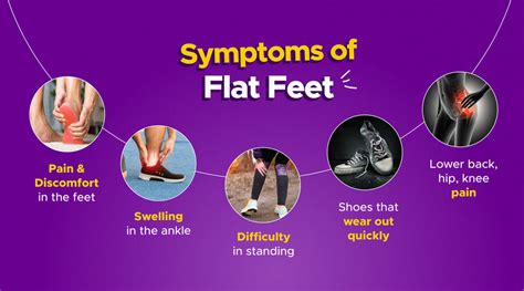 Flat feet: Causes and Symptoms - MyFrido