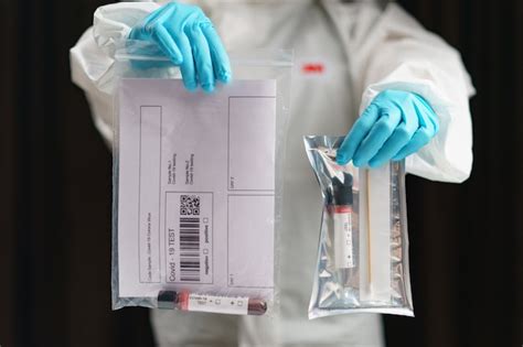 Proceso de prueba de coronavirus, una mano sostiene un tubo de muestras de análisis de sangre y ...