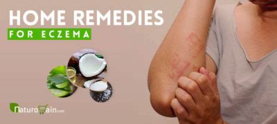 10 Natural Home Remedies for Eczema and Itching that Work