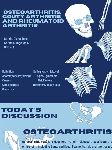 Osteoarthritis, Gouty Arthritis, and Rheumatoid Arthritis | PDF | Gout | Arthritis
