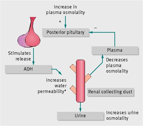 Investigating polyuria | The BMJ | Anatomy and physiology, Medical ...