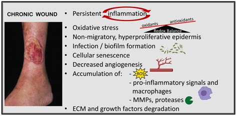 IJMS | Free Full-Text | Chronic Inflammation in Non-Healing Skin Wounds and Promising Natural ...