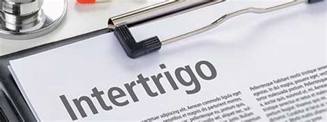 Intertrigo: Causes, Symptoms And Treatment | Netmeds