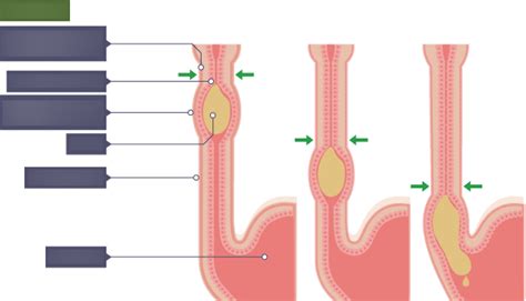 Biology - The Digestive System - Peristalsis Diagram | Quizlet