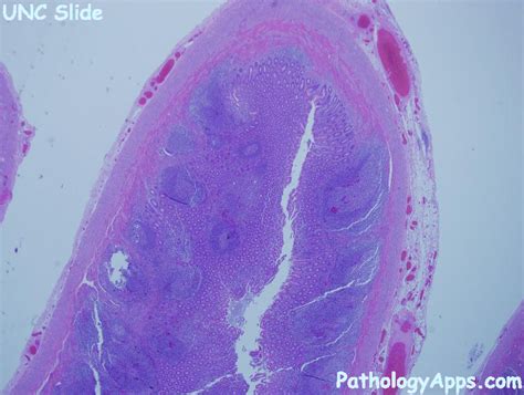 normal appendix histology