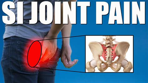 SI JOINT PAIN (SACROILIAC) BEST Exercises, Stretches & Advice for Back ...