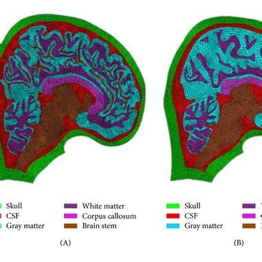 The development process of the models with and without gyri and sulci ...