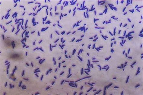 The Simple Stains - Microbiology learning: The "why"ology of microbial ...