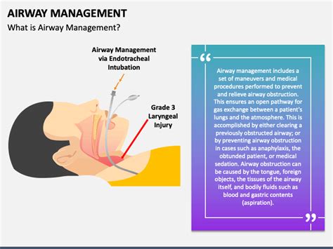 Airway Management | Airway management, Management, Presentation