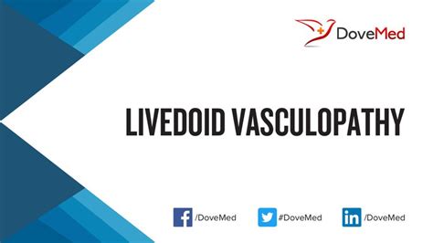 Livedoid Vasculopathy