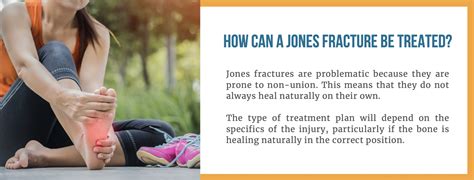 What is a Jones Fracture? All your questions answered here