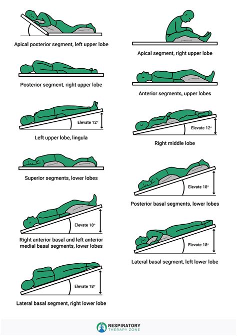 Postural Drainage Positions and Chest Physical Therapy (CPT)