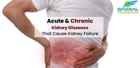 kidney diseases that cause kidney failure - Bansal Hospital