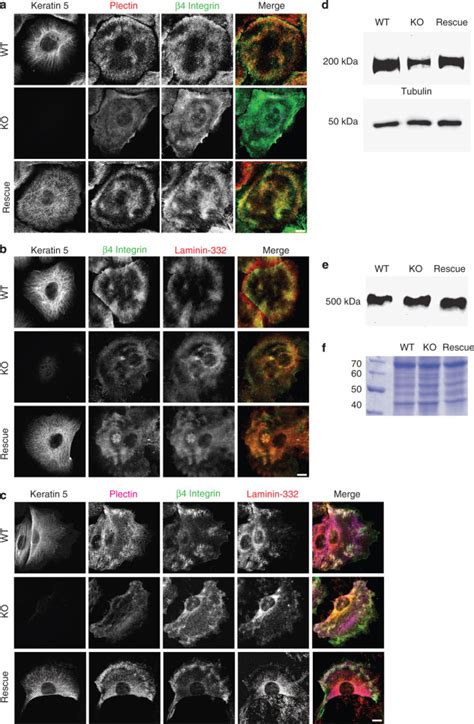 Keratins Mediate Localization of Hemidesmosomes and Repress Cell ...