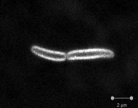 Fogonazos: Una E. coli sintética que produce proteínas a la carta