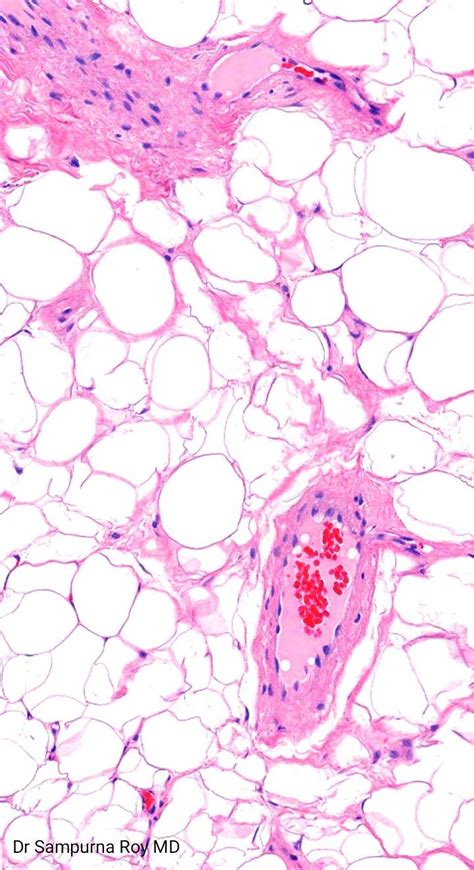 #roypath #pathology #histopathology #dermatopathology #pathologist # ...