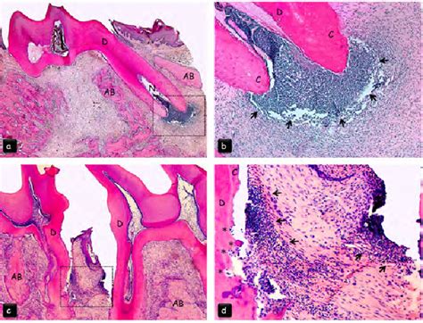 Histological overview (a, b) Intense acute inflammatory response (black... | Download Scientific ...