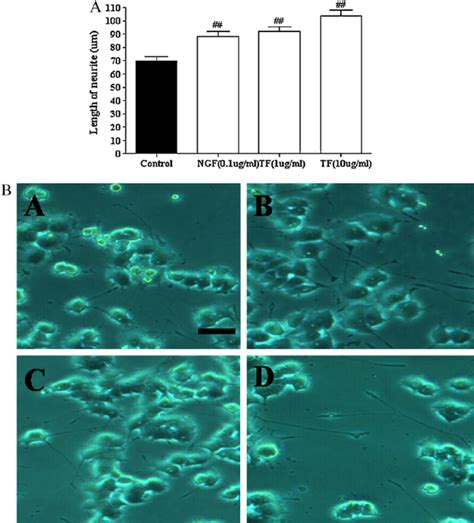 (a) Neurite outgrowth induced by treatment with the TF water extract ...