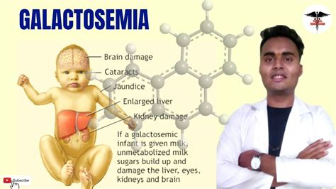 WHAT IS GALACTOSEMIA ?? || CLINICAL ASPECTS || DIAGNOSIS | ENZYME DEFICIENT | TREATMENT . - YouTube