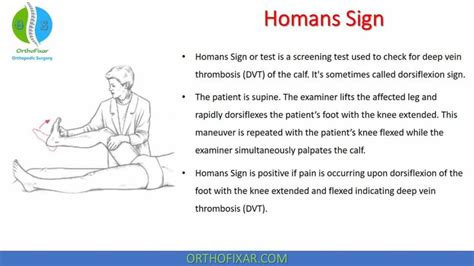 Homans Sign | DVT Tests • Easy Explained - OrthoFixar 2022 | Homans sign, Complex regional pain ...