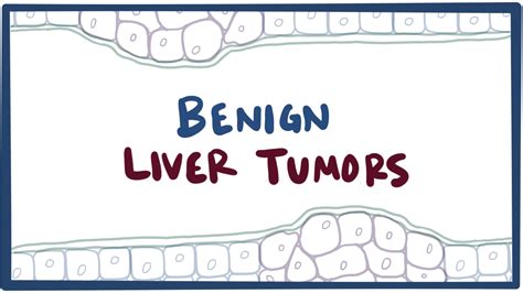 Benign liver tumors: Video, Causes, & Meaning | Osmosis