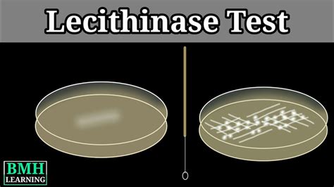 Lecithinase Test | Nagler's Reaction | Clostridium Testing Method ...