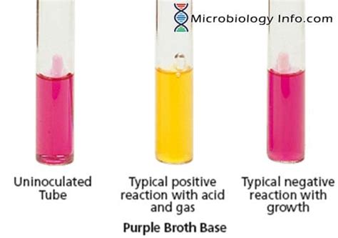 Fermentation Test - Principle, Procedure, Uses and Interpretation