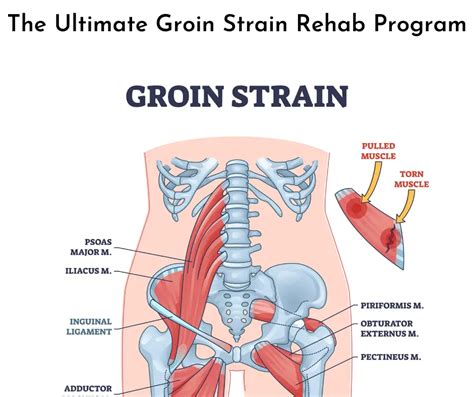 Three Reasons Your Groin Strain Is Taking Forever to Heal - Kadalyst PT