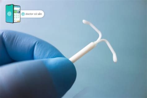 Copper IUD: Your comprehensive guide | Doctor có sẵn