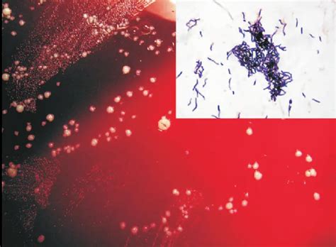 Actinomyces: Properties, Disease, Lab Diagnosis • Microbe Online