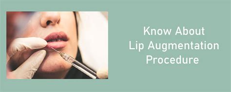 Know About Lip Augmentation Procedure | Blog