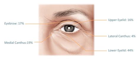 Eyelid Cancer Newport Beach | Melanoma Removal Orange County