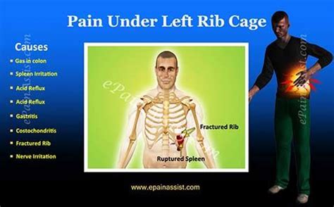 What Body Parts Are Under The Rib Cage / Pain Under Right Rib Cage: 12 ...