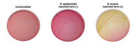 1.29: Mannitol Salt Agar - Biology LibreTexts