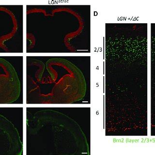 The overall brain morphology of LGN mutants does not differ from that ...