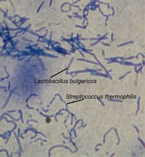 Experiment 38 - General & Medical Microbiology Lab