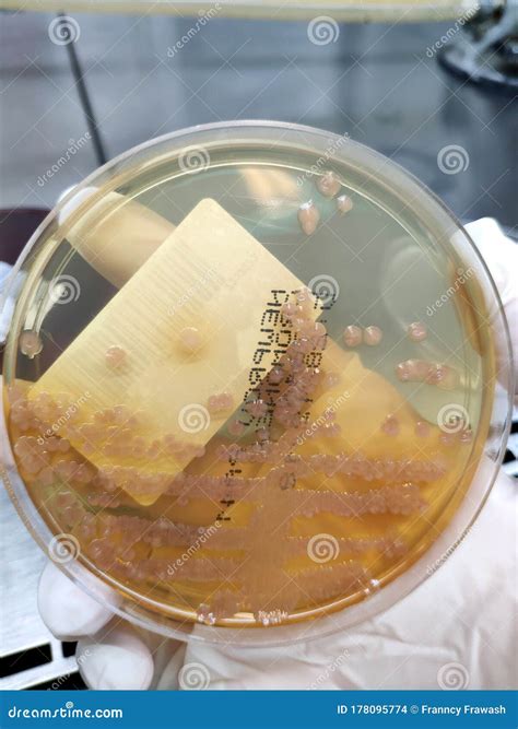 Morganella Morganii, Sample Culture - Microbiology Stock Photo - Image ...