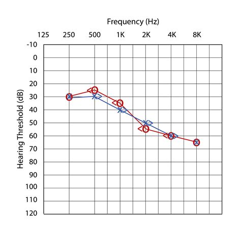 The Audiogram: your guide to reading it — Hearwell Audiology Clinic