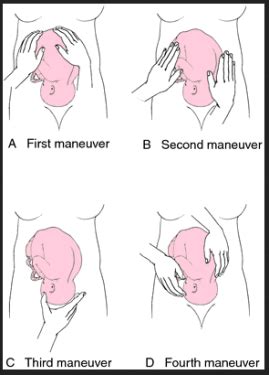 Image result for first step of leopold's maneuver | Midwifery, Child nursing, Midwifery student