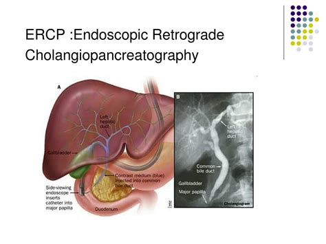 PPT - Gallbladder and Bile Ducts PowerPoint Presentation - ID:216315