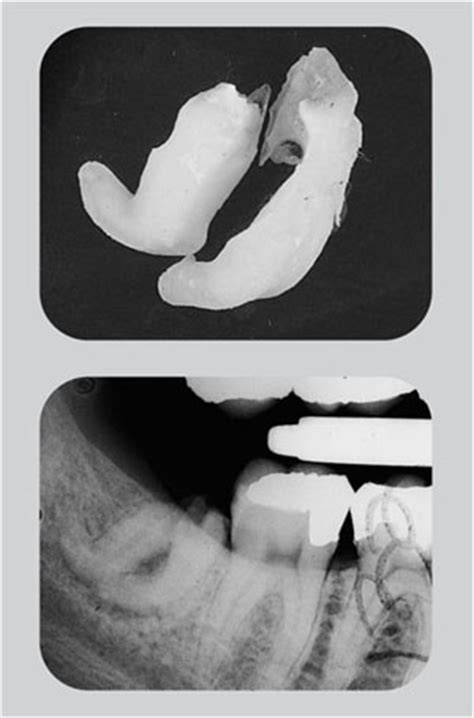 8: Assessment of Roots and Unerupted Teeth | Pocket Dentistry